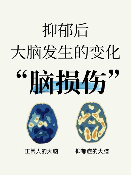 长期抑郁：影响大脑健康与寿命之谜