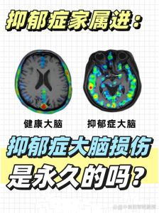 抑郁症：大脑与心理的神秘联系与应对策略
