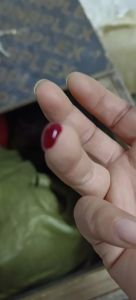 梦手指出血预示何意？应对挑战指南