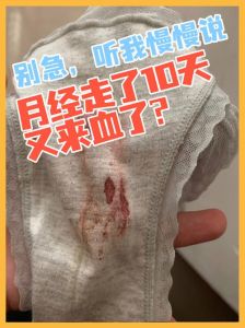 解梦梦见来姨妈流血的心理寓意