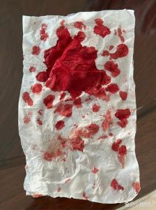 解密梦境：食指破裂流血的深层象征