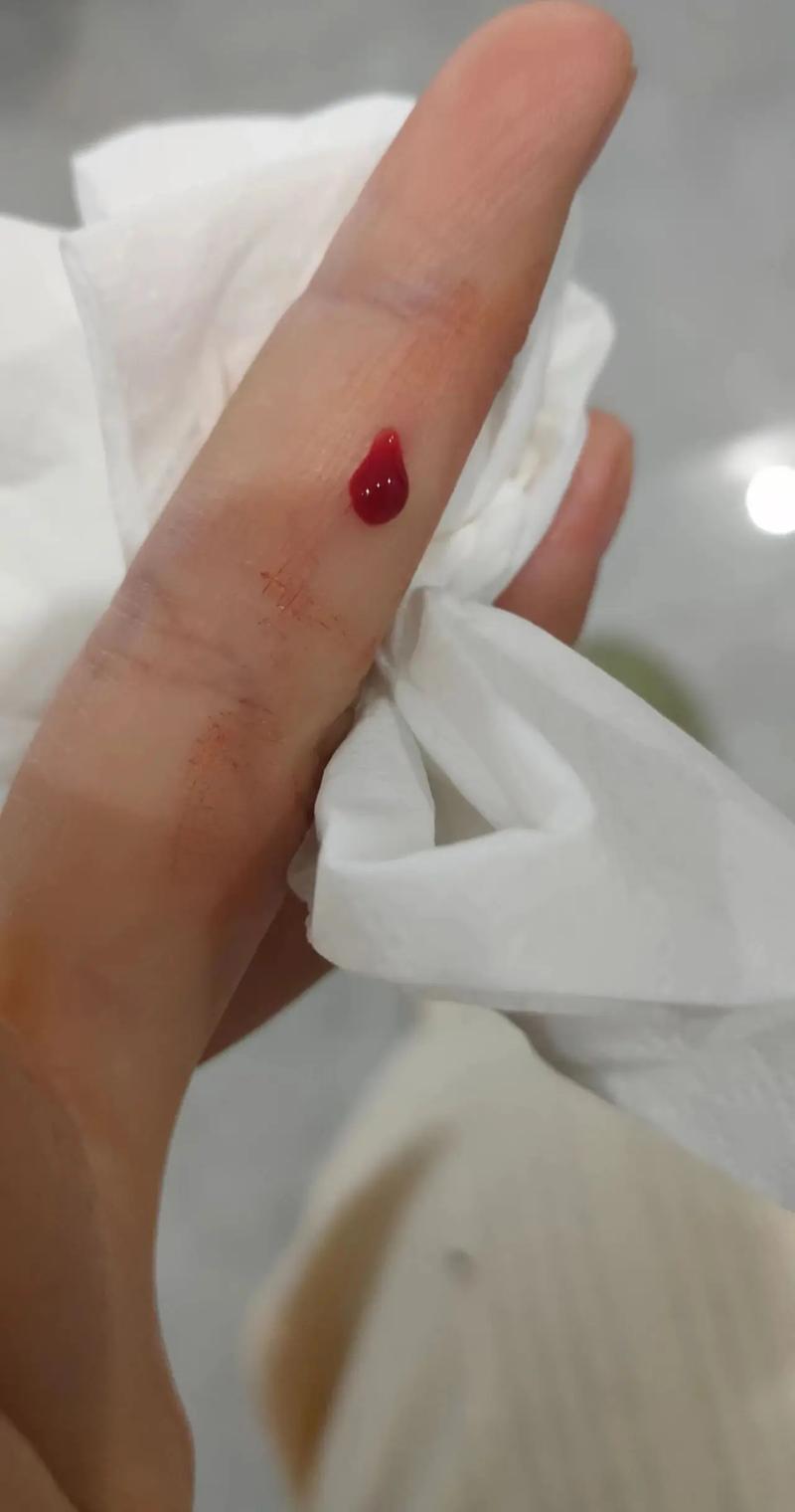 手出血梦境解析：吉凶之谜揭晓