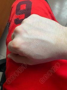 手够不到后背？原因及改善策略
