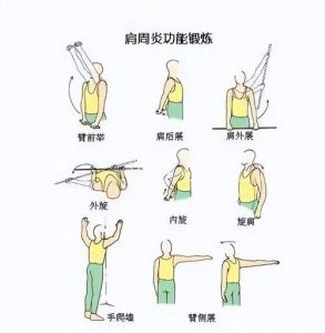 右手摸不到肩胛骨？康复之路及对策