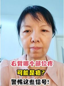 肩部不适解密：轻松解决右胳膊后背痛秘籍