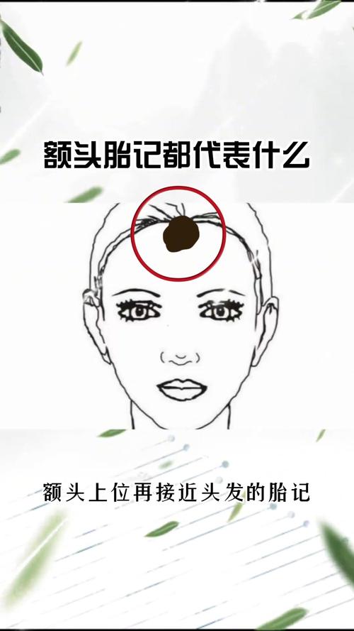 额头胎记：命运之谜，相学解读与现代医学看法