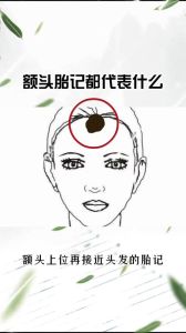 额头胎记：命运之谜，相学解读与现代医学看法