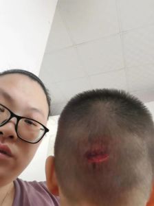 梦见头上流血：梦境吉凶与应对策略