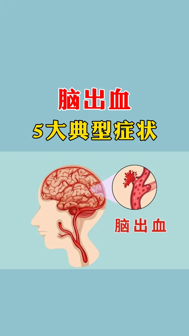 头部出血梦解析：预示好运的神秘暗示！