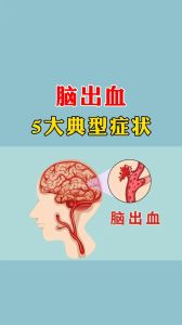 头部出血梦解析：预示好运的神秘暗示！