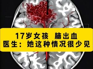 梦见头上出血预示什么？财运健康人际关系影响