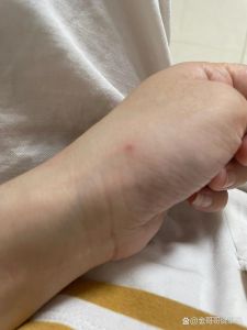 解密梦境：狗咬梦的深层含义与生活启示