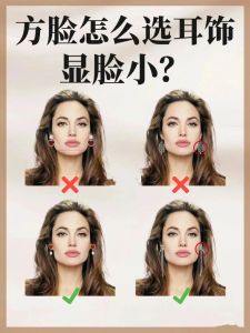 方脸改善全攻略：玻尿酸面部提升术，重塑完美轮廓！