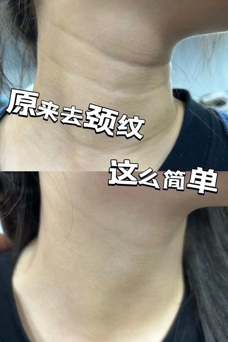 告别颈纹，光滑美颈秘籍大公开！