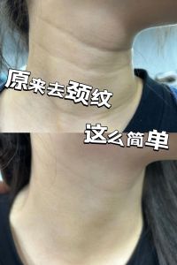 告别颈纹，光滑美颈秘籍大公开！