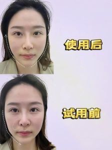 面部提升：多重方法助你焕发青春光彩