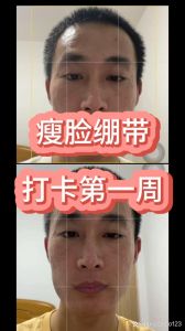 男士肌肤松弛全方位抗衰老指南
