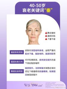 全方位抗衰秘籍：热门项目与日常保养技巧