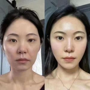 抗衰老治疗副作用安全变美指南