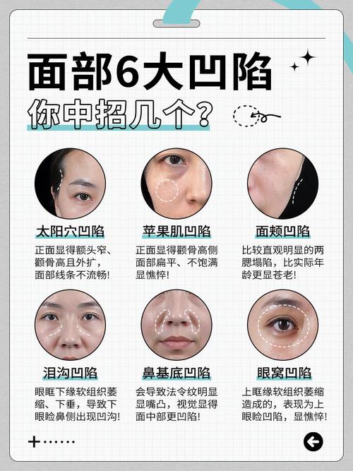 脸颊凹陷：自然恢复方法助你重拾饱满笑容