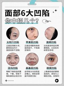 脸颊凹陷：自然恢复方法助你重拾饱满笑容
