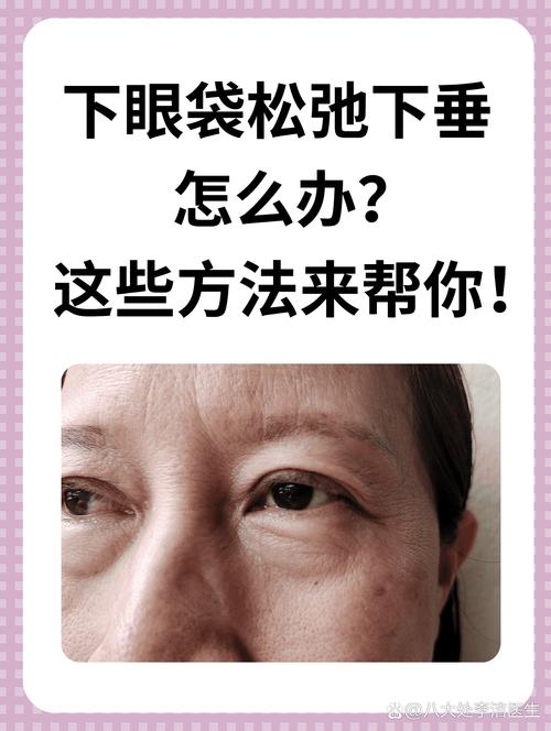 全方位抗衰老攻略：告别松弛，重拾青春光彩