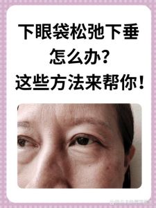 全方位抗衰老攻略：告别松弛，重拾青春光彩