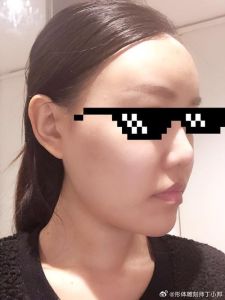 额头松弛成因及抗衰老护肤之旅