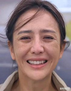 40岁抗衰老攻略：全方位护肤医美，重拾青春光彩