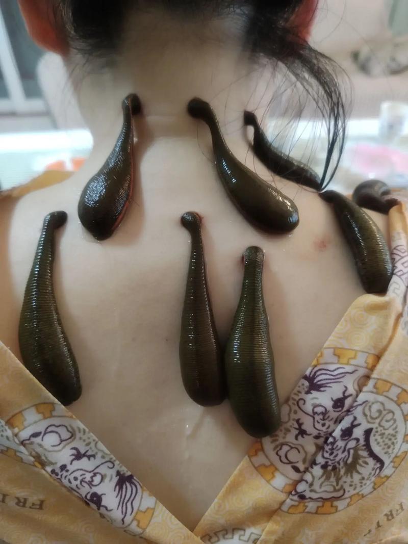 已婚女人梦见水蛭：财富健康与婚姻启示