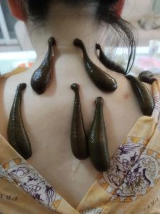 已婚女人梦见水蛭：财富健康与婚姻启示