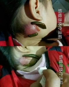 梦境水蛭寓意探寻财富警示的潜意识之旅