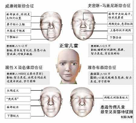 识别真假自闭症：早期干预与家长自测指南