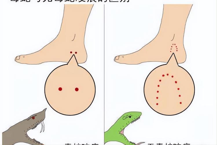 梦境：水蛭入侵皮肤，预示何意？