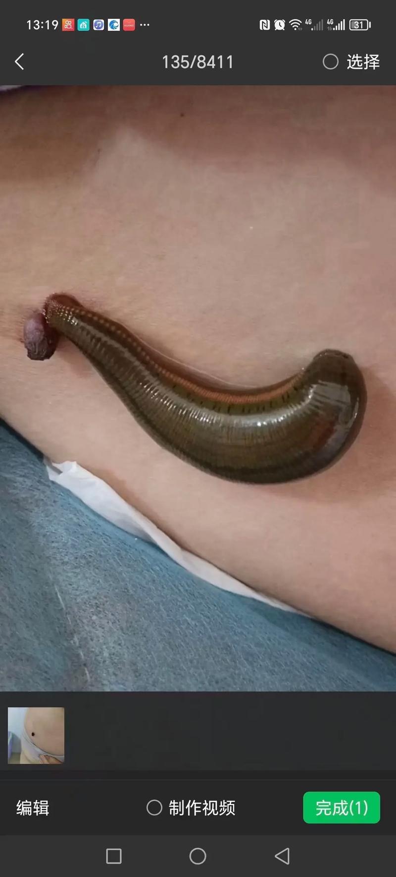 梦境女人拔蚂蝗的寓意与心灵启示