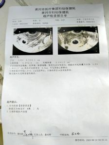 梦到怀三胎的寓意解析与启示