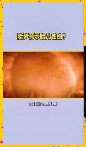 胎梦科学解析生女儿梦境真相