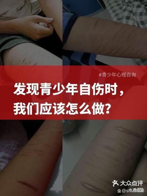 抑郁症好转迹象：康复曙光与生活重拾之道