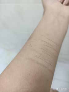 父母应对女儿自残：沟通与支持之道