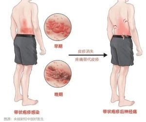 五大邪灵缠身征兆及驱邪方法！