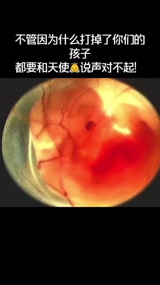 梦境解析：打掉孩子背后的心理密码与救赎之路