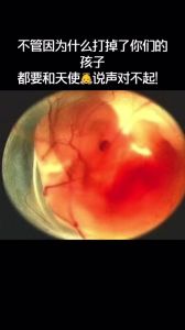 梦境解析：打掉孩子背后的心理密码与救赎之路