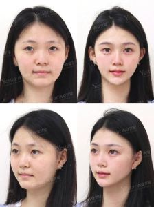 面部扁平女性：性格命运解析与旺夫财运