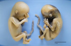 解密怀胎四胞胎梦境：七大预兆与女性特殊寓意