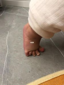 10岁儿童冬季赤脚的秘密与中医保健