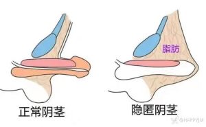 走路姿势性格与健康秘密解码