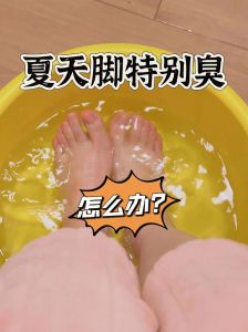 脚臭成因及告别脚臭攻略