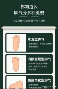 告别汗脚脚臭，轻松5招脚部清新指南